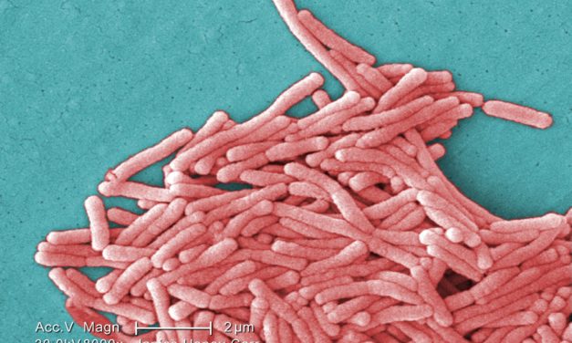 Health officials investigating three Legionnaires’ disease cases at two Chicago area nursing homes