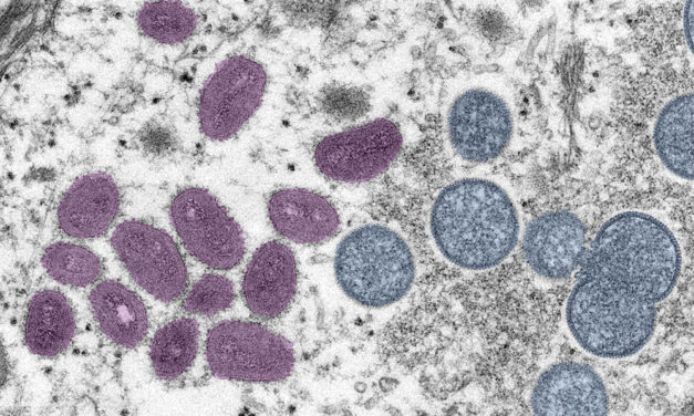 Illinois to receive 4,500 monkeypox virus vaccines